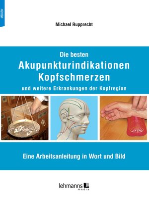 cover image of Die besten Akupunkturindikationen Kopfschmerzen und weitere Erkrankungen der Kopfregion